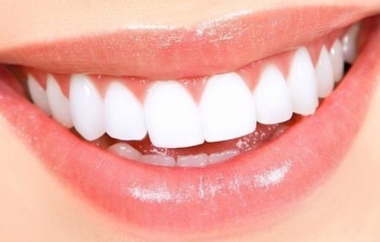 Красивая улыбка - результат качественного протезирования зубов