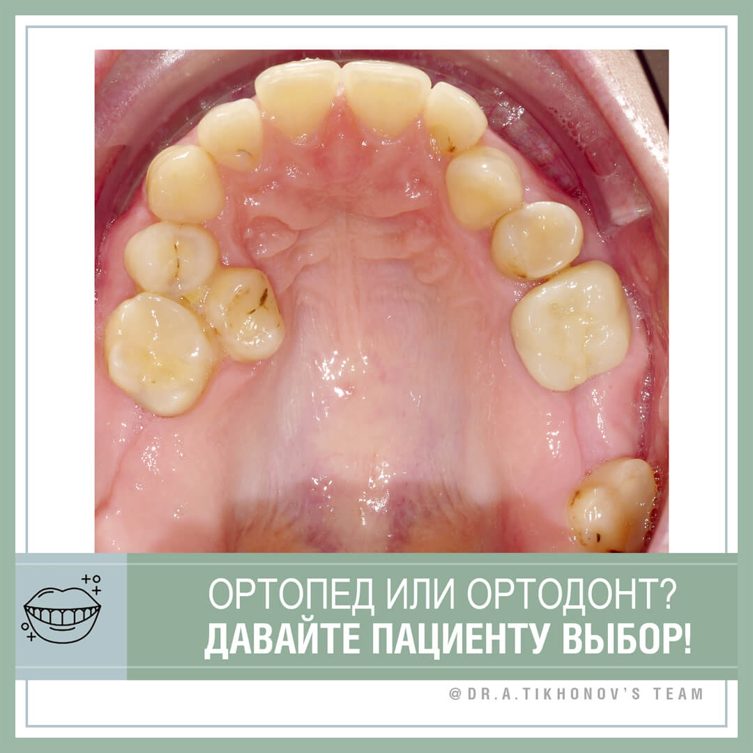 Ортопед или ортодонт? Давайте пациенту выбор!