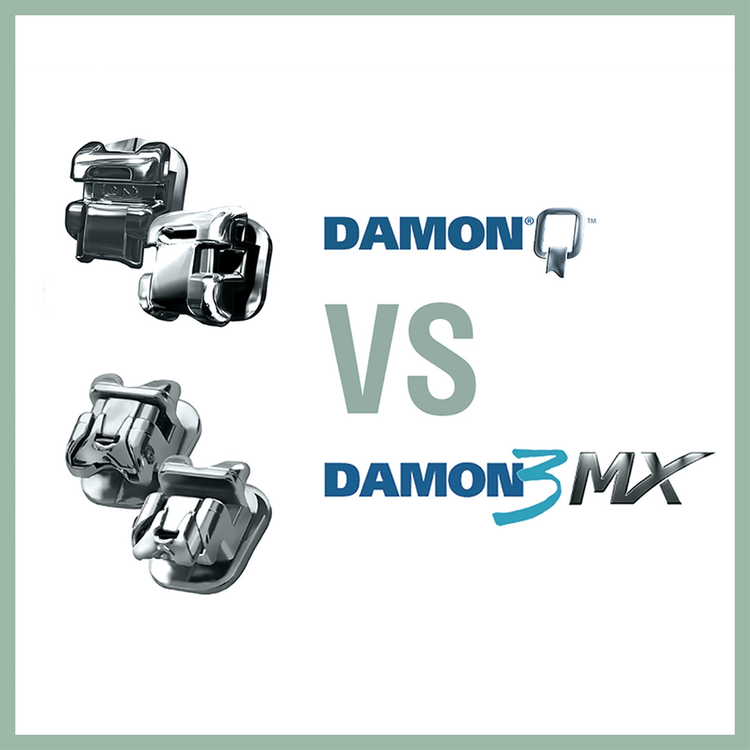 Чем отличаются брекеты Damon Q и брекеты Damon 3MX?