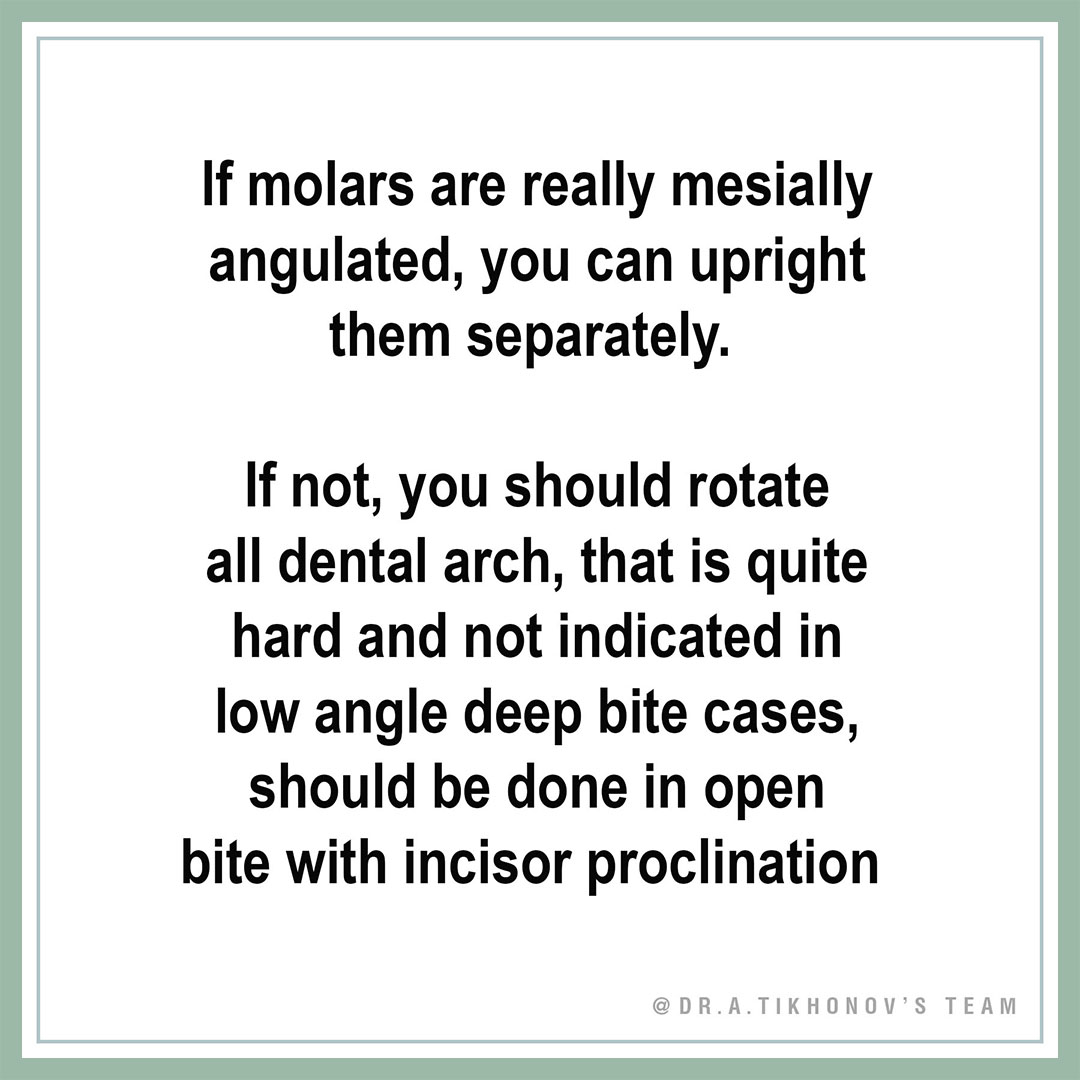 If molars are really mesially angulated, you can upright them separately