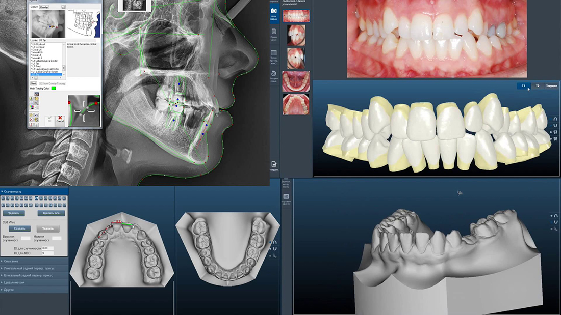 Диагностика у ортодонта