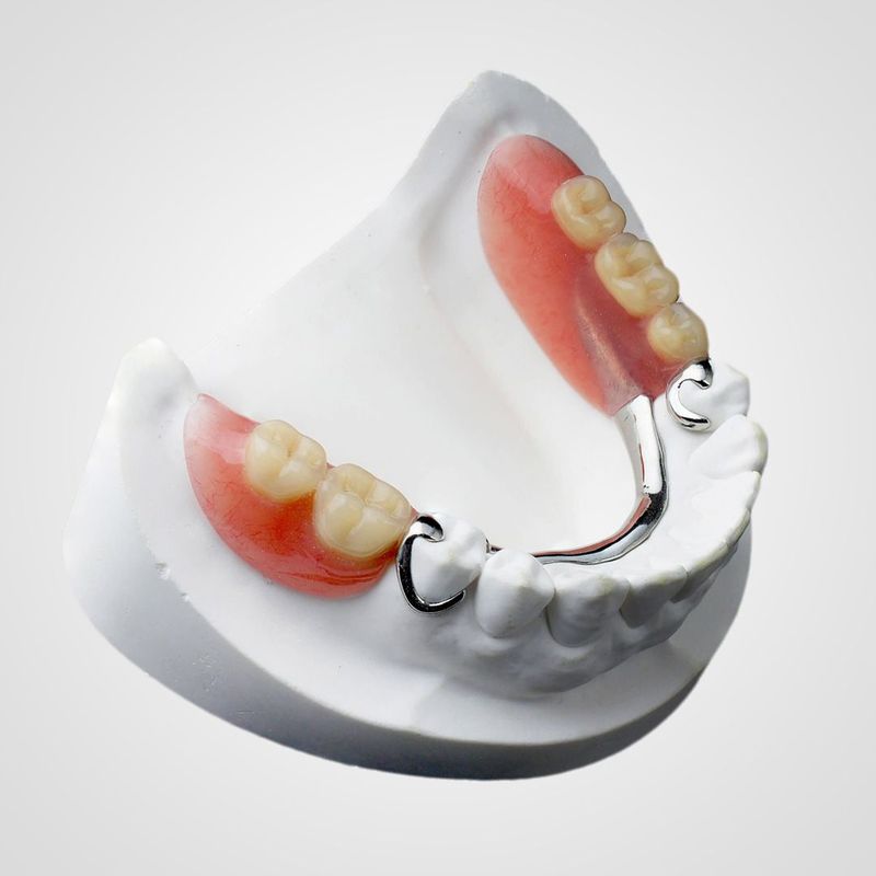 Протезирование при частичной адентии: съемные и несъемные зубные протезы