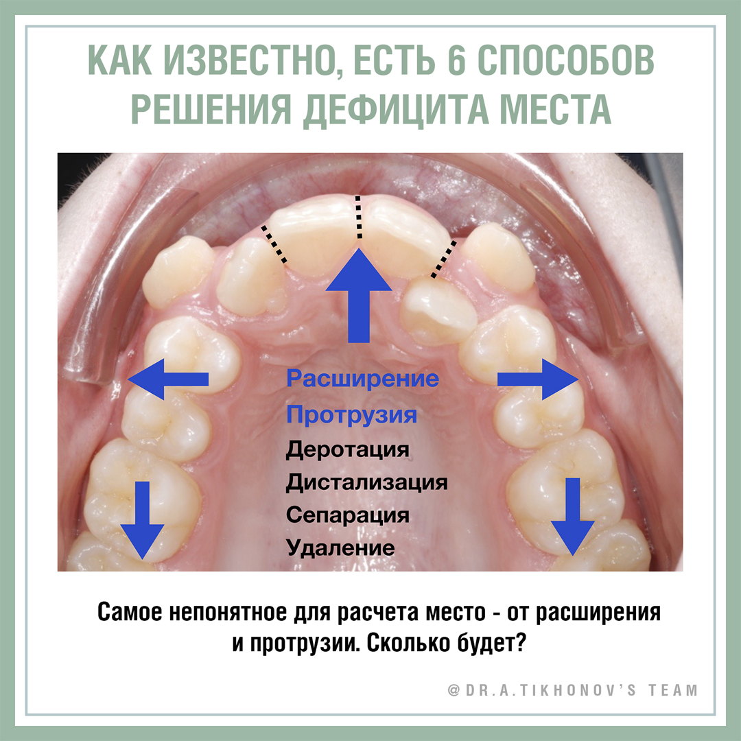 Есть 6 способов решения дефицита места