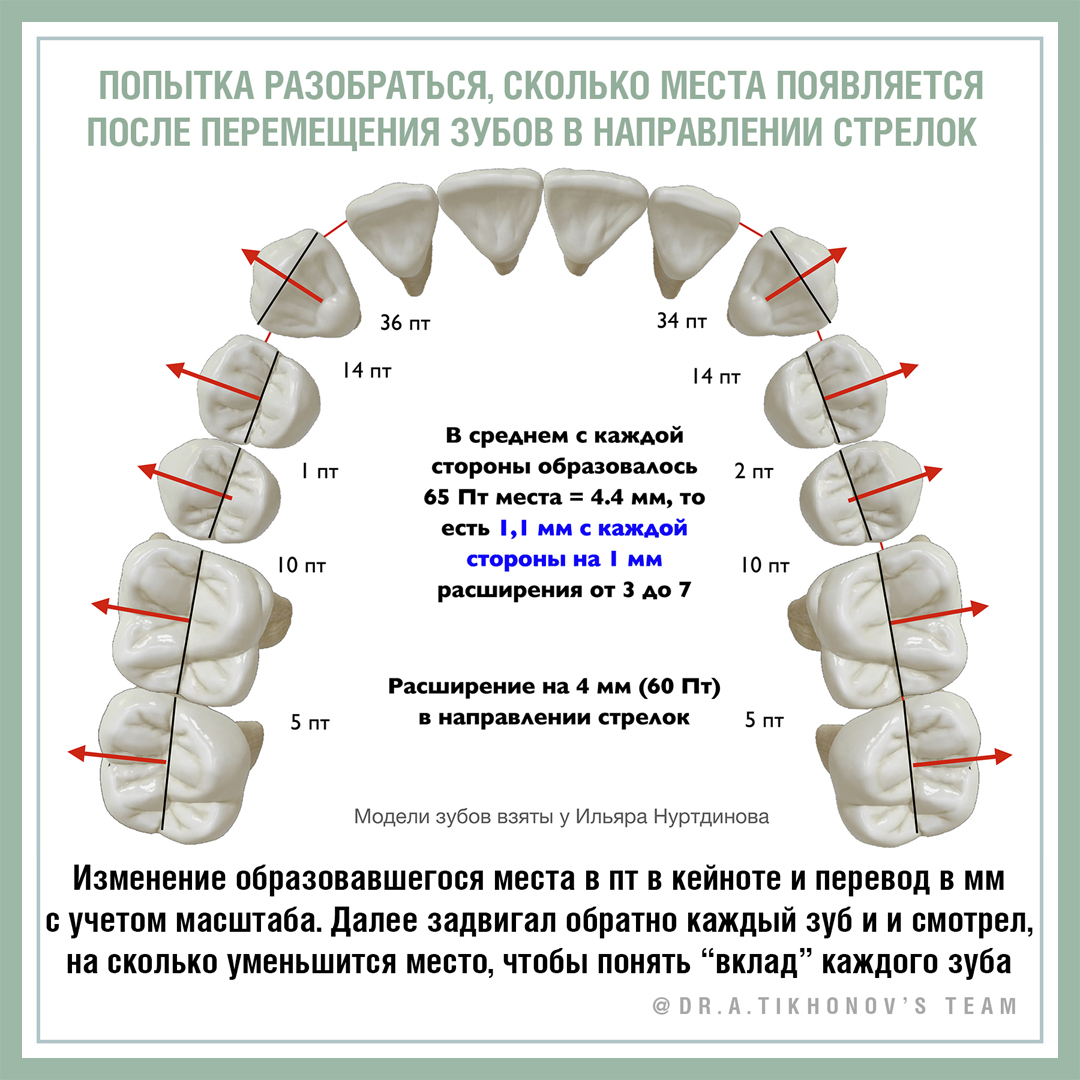 Попытка разобраться, сколько места появляется после перемещения зубов