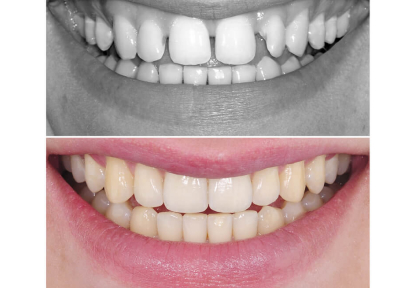 5 подходов при закрытии множественных трем