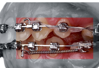 Коротко о пружинах и цепочках при закрытии пространства