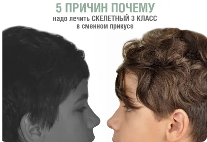 5 причин почему надо лечить скелетный 3 класс в сменном прикусе
