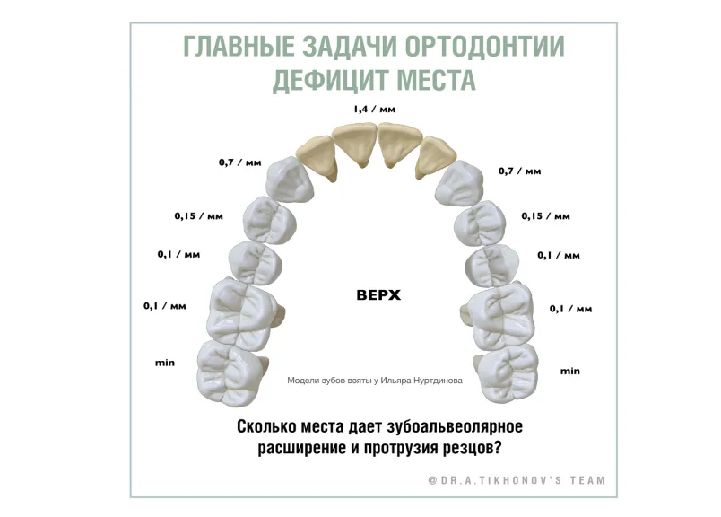 Главные задачи ортодонтии: дефицит места