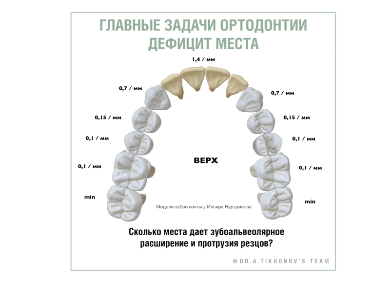 Главные задачи ортодонтии: дефицит места