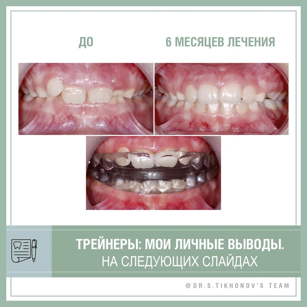 Трейнеры: личные выводы Сергей Тихонова