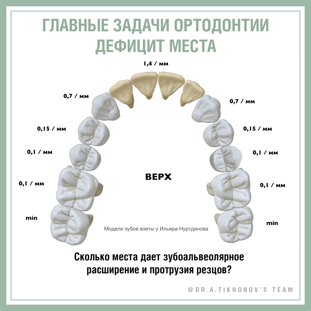 Главные задачи ортодонтии: дефицит места.