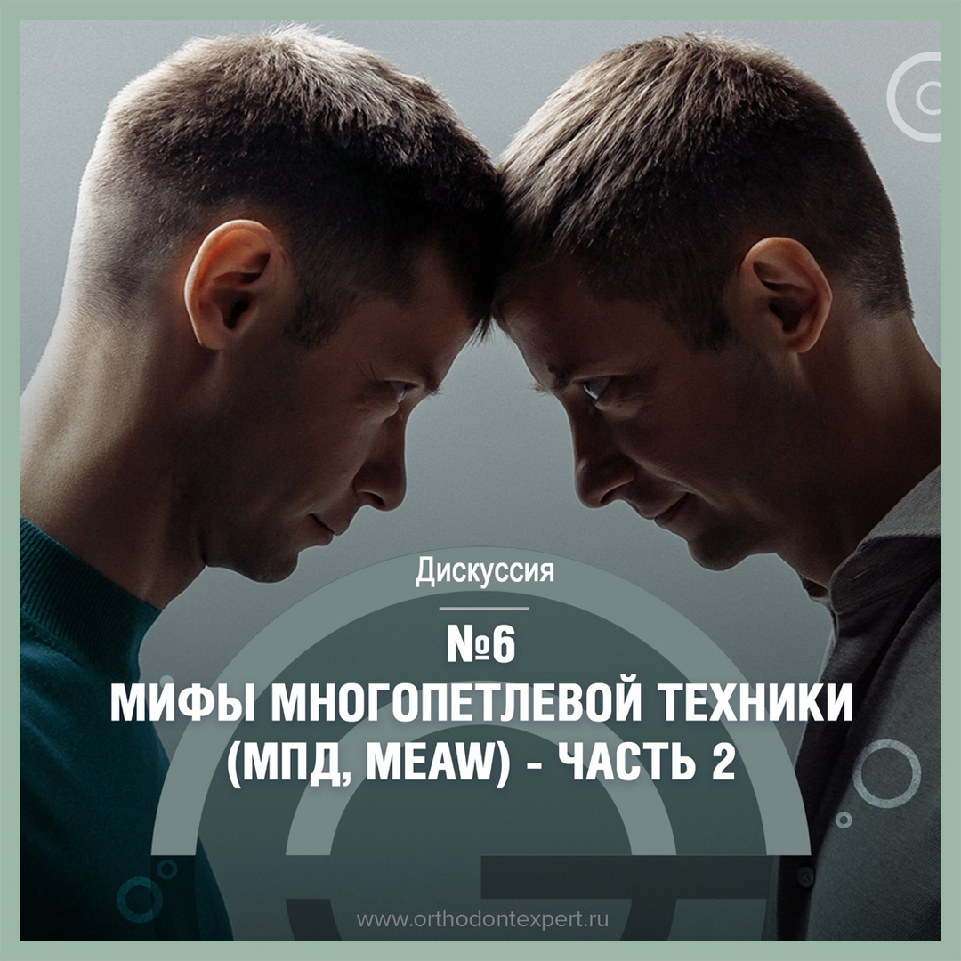 Мифы многопетлевой техники – МПД, MEAW. Часть 2.