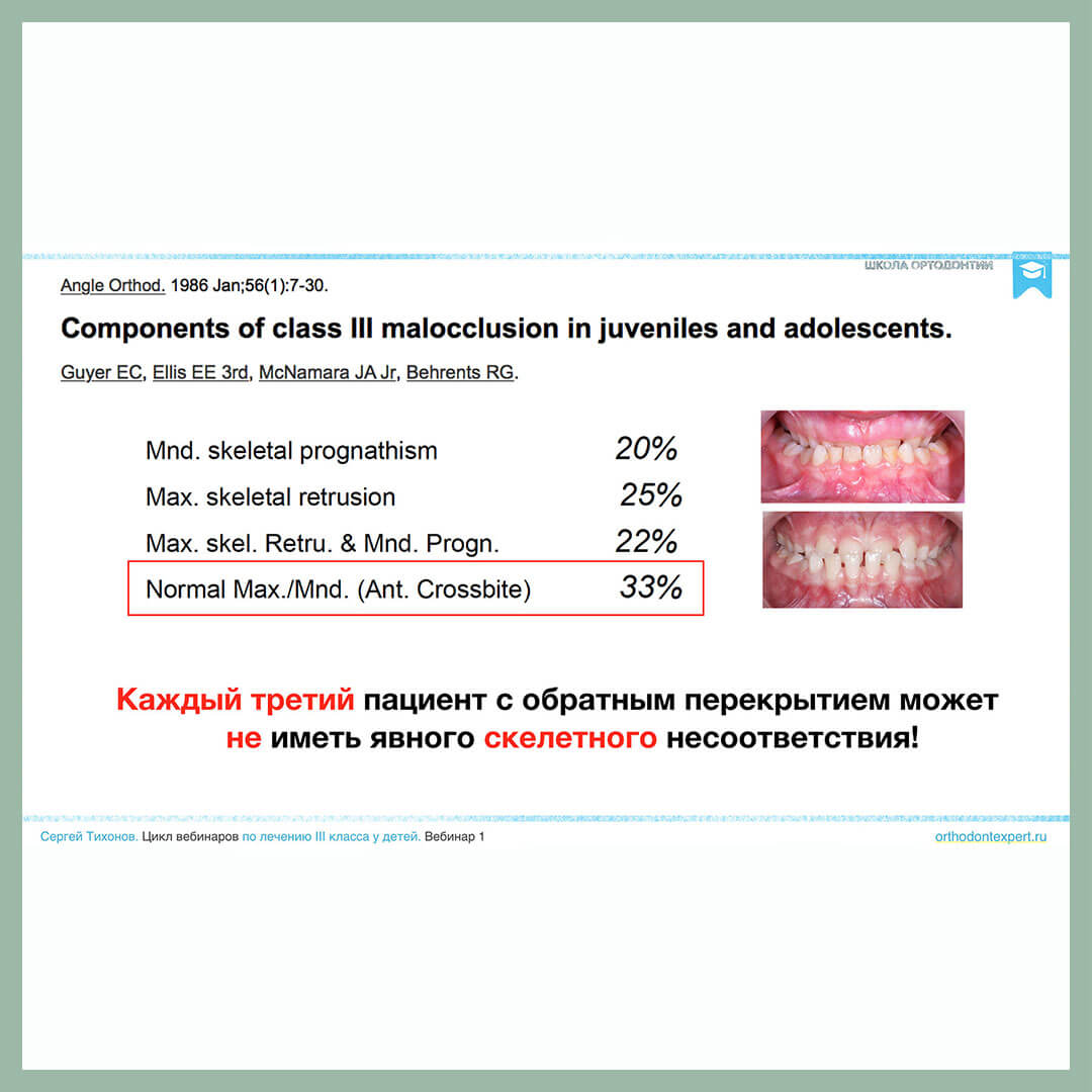 Каждый третий пациент с обратным перекрытием может не иметь явного скелетного несоответствия