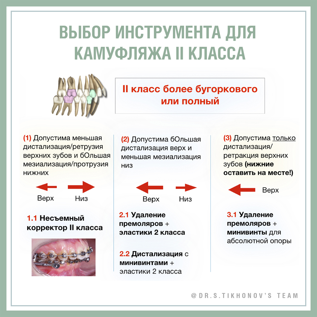 Выбор инструмента для камуфляжа II класса