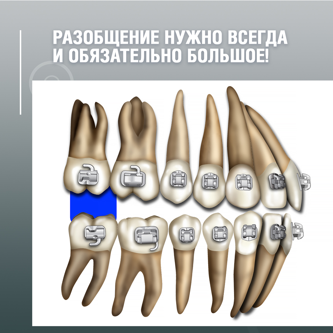 Разобщение нужно всегда и обязательно большое