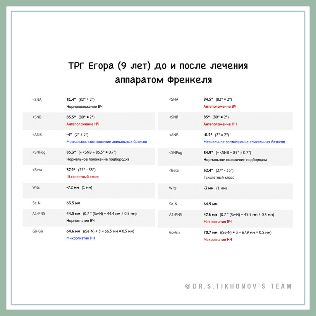 Скелетные эффекты аппарата Френкеля III типа