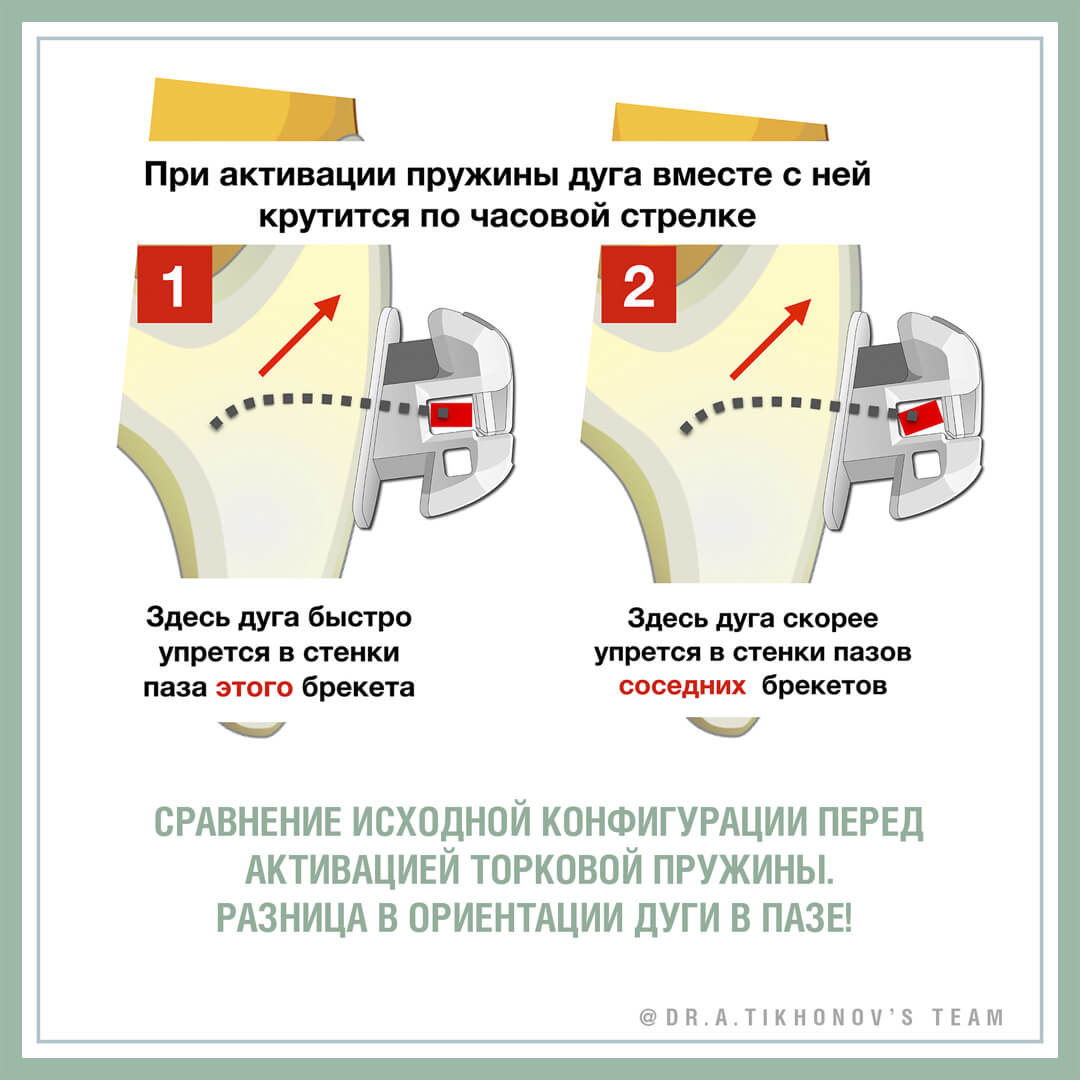 Сравнение исходной конфигурации перед активацией торковой пружины. Разница в ориентации дуги в пазе!