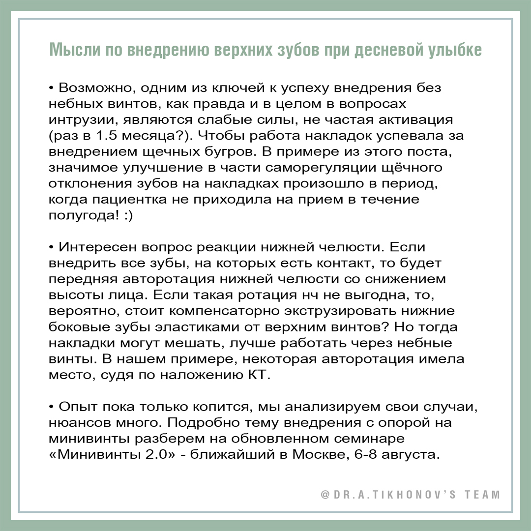 Мысли по внедрению верхних зубов при десневой улыбке