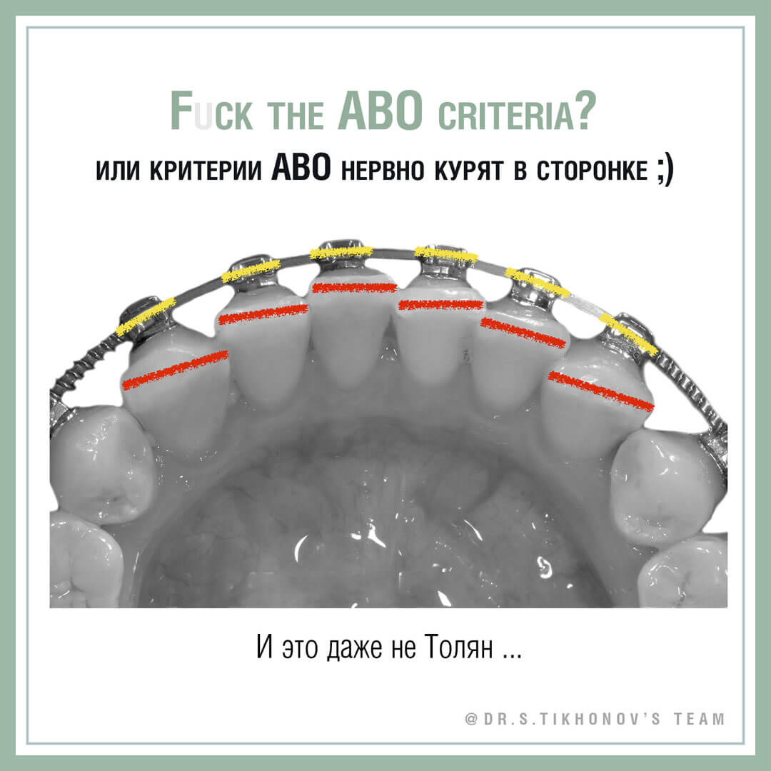 F.U.S.K. the ABO criteria