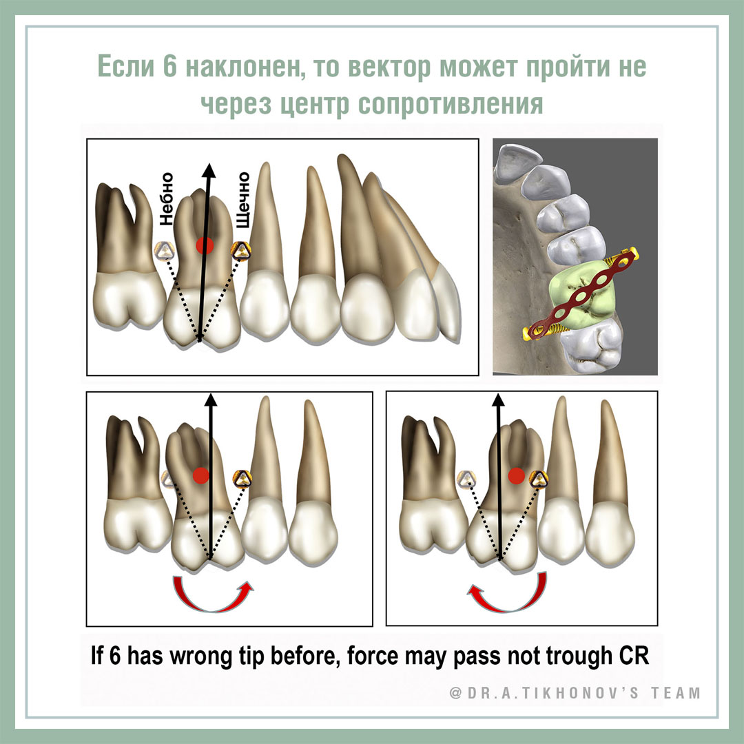 Если 6 наклонен, то вектор может пройти не через центр сопротивления