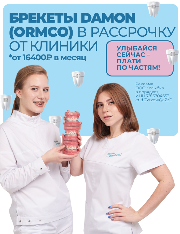 Рассрочка от клиники на брекеты — от 16400 рублей в месяц