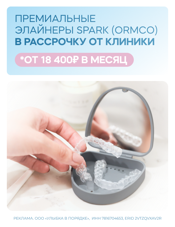 Премиальные элайнеры SPARK – в рассрочку от 18400 рублей в месяц