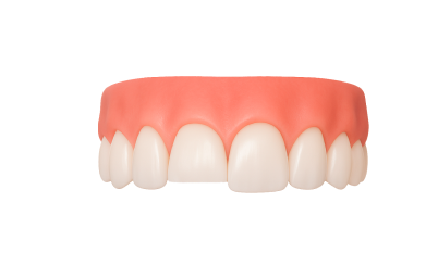 Лечение бруксизма