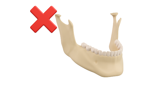 Лечение дисфункции височно-нижнечелюстного сустава (ВНЧС) 