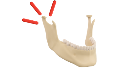Лечение щелчков в челюсти