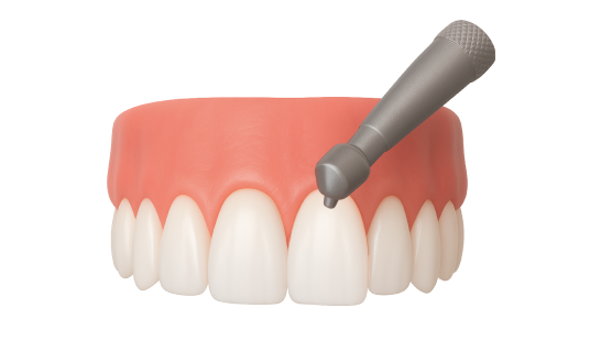 Закрытие рецессии