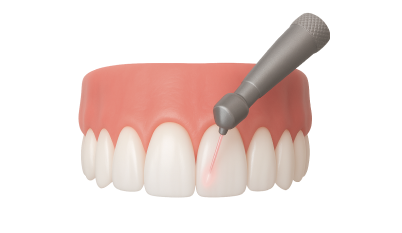 Закрытие рецессии