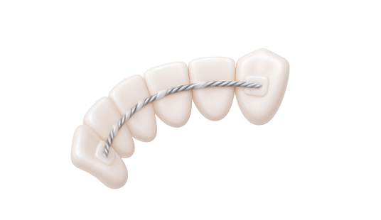 Закрытие рецессии