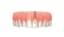 Консультация с составлением плана лечения