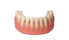 Закрытие рецессии