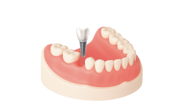 Консультация с составлением плана лечения