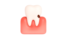 Профессиональная гигиена зубов