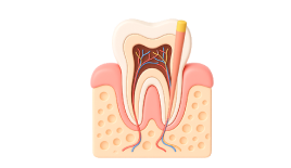 Профессиональная гигиена зубов