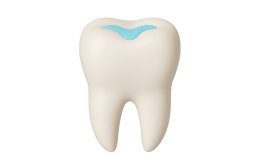 Пломба на зуб