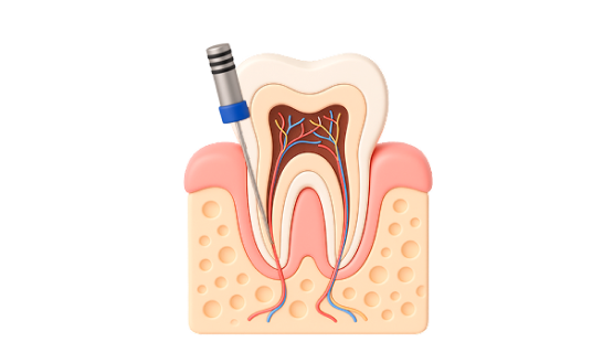 Профессиональная гигиена зубов