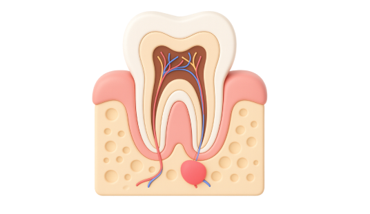 Профессиональная гигиена зубов