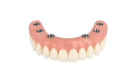 Консультация с составлением плана лечения