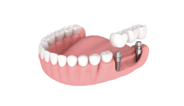 Консультация с составлением плана лечения