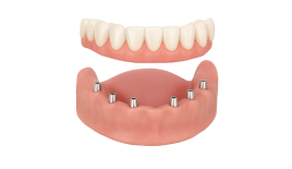 Консультация с составлением плана лечения