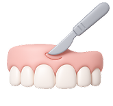 Удлинение клинической коронки зуба