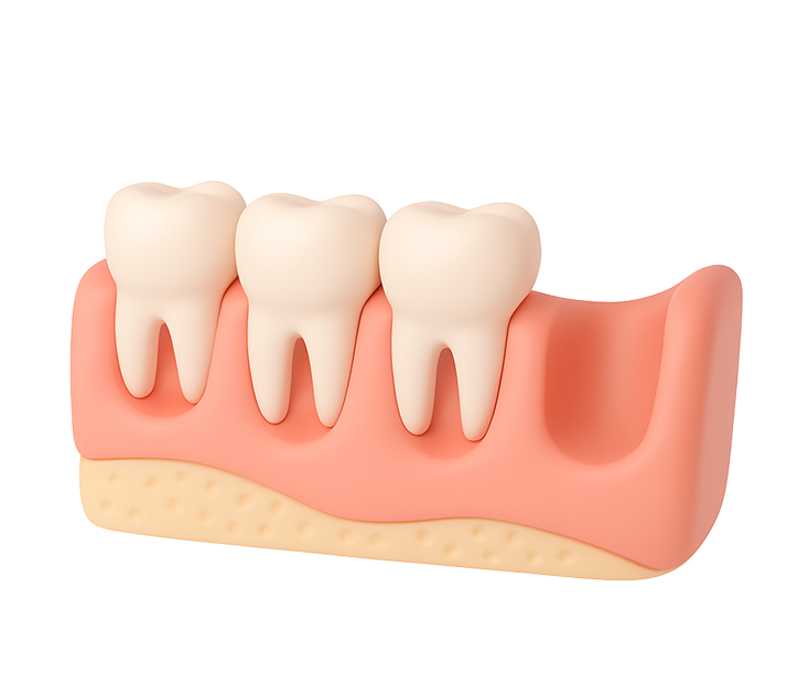 Удаление зуба мудрости