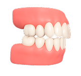 Исправление дистального прикуса