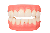 Лечение скученности зубов