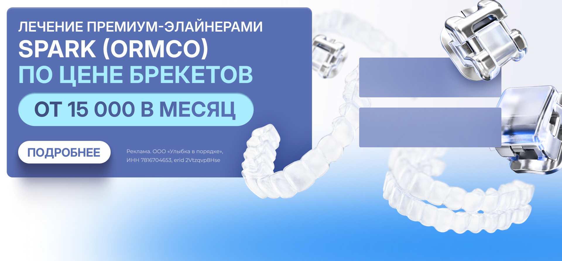 Спарк по цене брекетов