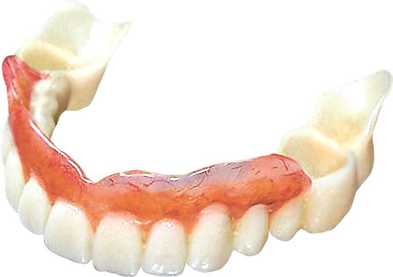 Протезирование жевательных зубов коронками: варианты и стоимость